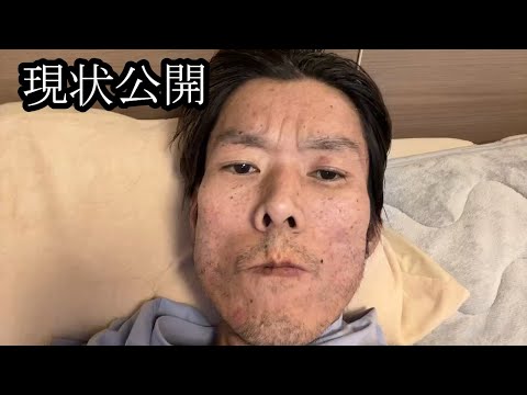 【人生の山場】皆さんにある報告があります【金バエ】